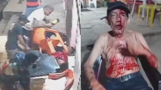 Man Attacked With Bottles And Chairs, Stabbed Outside The Bar In Brazil