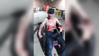 Man Attacked With Bottles And Chairs, Stabbed Outside The Bar In Brazil