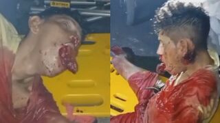 Gang Members Cut His Tongue Off And Left Him Dying On The Street