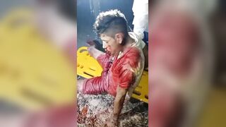 Gang Members Cut His Tongue Off And Left Him Dying On The Street