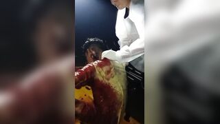 Gang Members Cut His Tongue Off And Left Him Dying On The Street