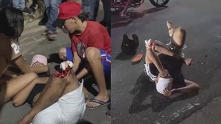 Man Hit By Motorcycle Suffers Terrible Injury