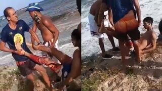 Surfer Is A Shark Attack Survivor In Pernambuco, Brasil