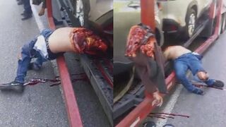 Gruesome Aftermath Of Motorcyle Accident In Venezuela