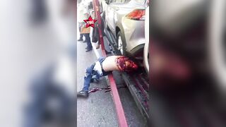 Gruesome Aftermath Of Motorcyle Accident In Venezuela