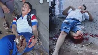 Motorcycle Accident Leaves Two Men With Terrible Injuries
