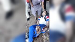 Motorcycle Accident Leaves Two Men With Terrible Injuries