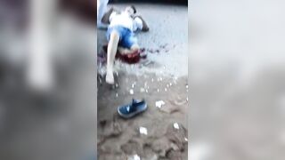 Motorcycle Accident Leaves Two Men With Terrible Injuries