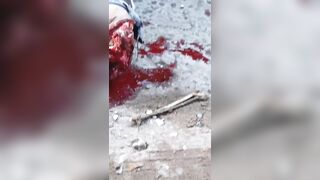 Motorcycle Accident Leaves Two Men With Terrible Injuries