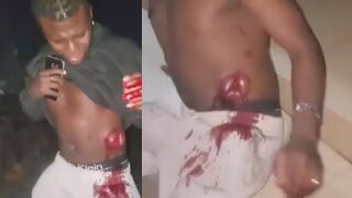 Man Walks With Guts Exposed After Being Stabbed