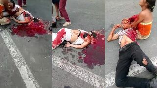 Nasty bike crash