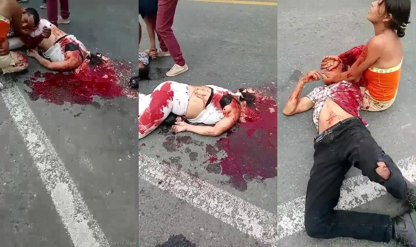 Nasty bike crash