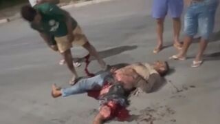 Accident Victim Is Lucky (?) To Be Alive