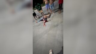 Accident Victim Is Lucky (?) To Be Alive