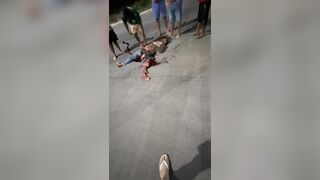 Accident Victim Is Lucky (?) To Be Alive