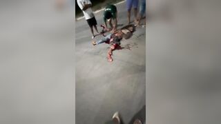 Accident Victim Is Lucky (?) To Be Alive