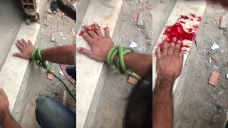 Fingers Chopped Off For Stealing