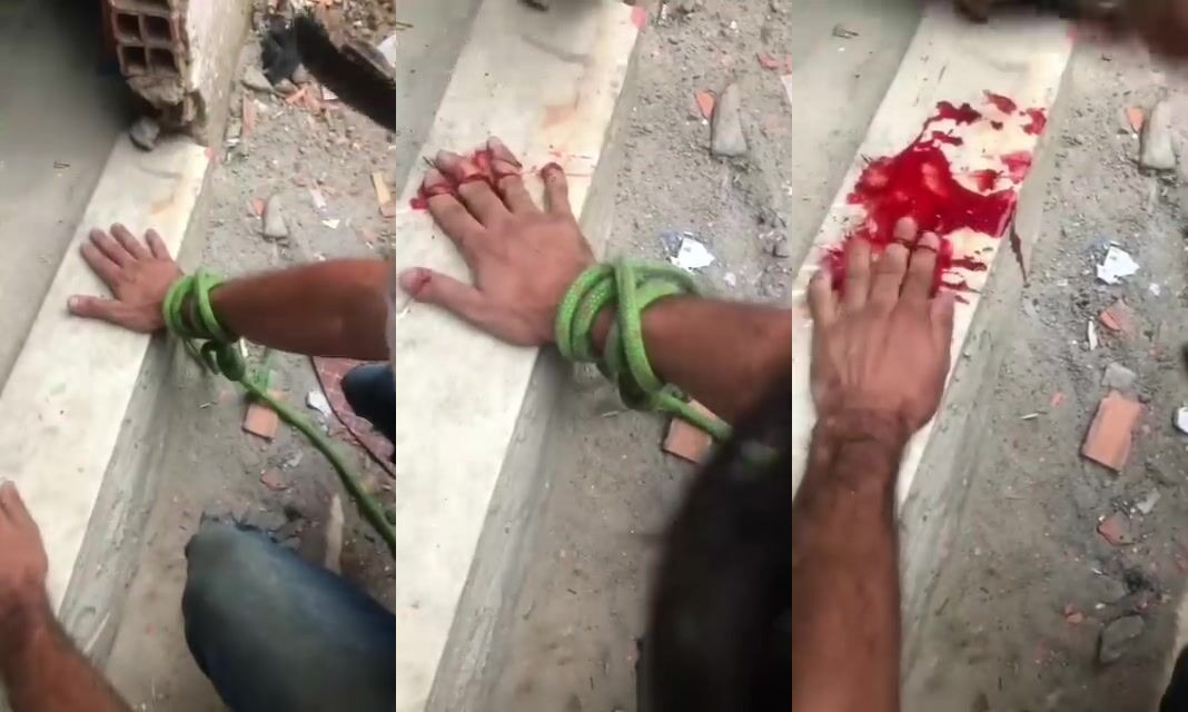 Fingers Chopped Off For Stealing