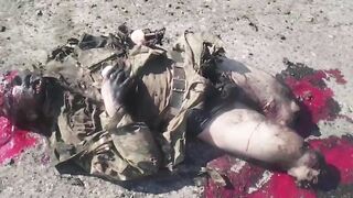 A Russian soldier was blown up by an IED (Improvised Explosive Device)
