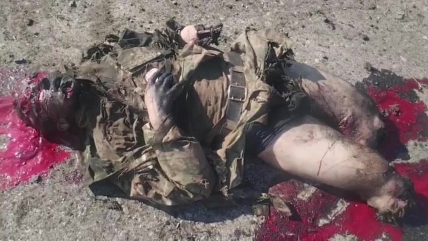 A Russian soldier was blown up by an IED (Improvised Explosive Device)