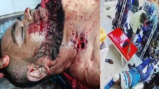 Three Men Unleash Shotgun Hell and Frenzied Stabbings on Helpless Victim