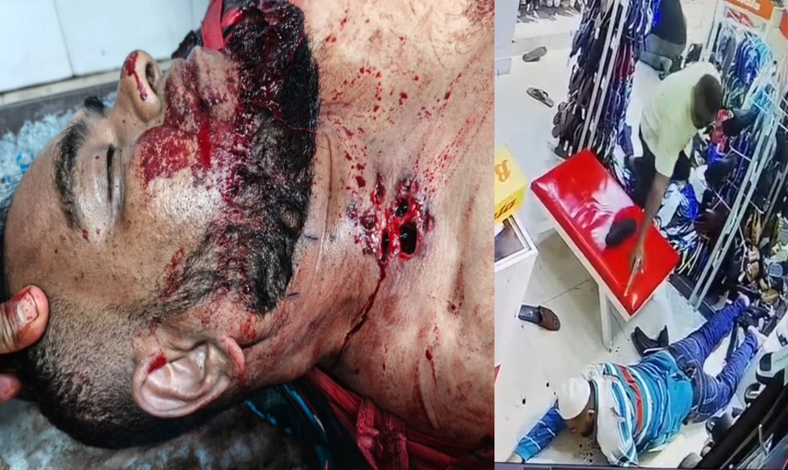 Three Men Unleash Shotgun Hell and Frenzied Stabbings on Helpless Victim