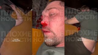 Russian pedo punished hard for sexually assaulting little girl