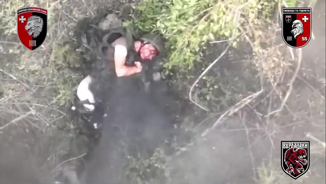 Russian lost his hand and was killed by shrapnel