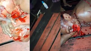 Man seriously injured after sword attack