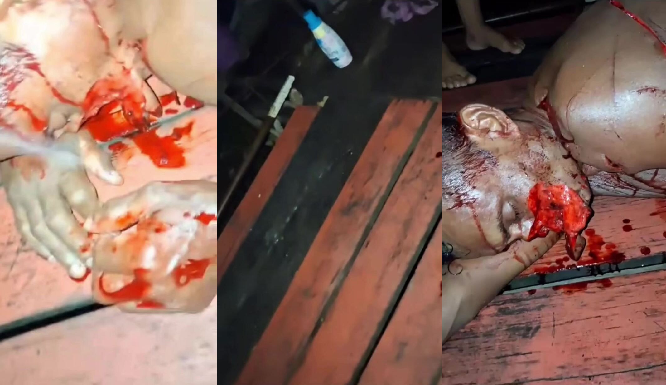 Man seriously injured after sword attack