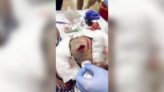 Russian wounded soldier hospitalized