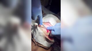 Russian wounded soldier hospitalized