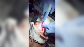 Russian wounded soldier hospitalized