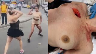 Woman Gets Fatally Stabbed In Chest During Street Fight
