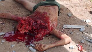 Car at Mach Fuck Obliterates Cyclist, Head Explodes Like Watermelon