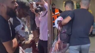 Young Man Seriously Injured Following Israli Strike