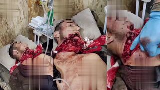 Soldier had his jaw blown off