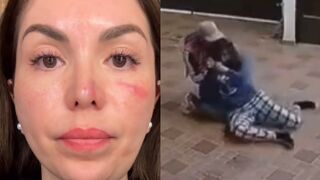 Helpless Woman Attacked, Put On Chokehold During Robbery In Mexico