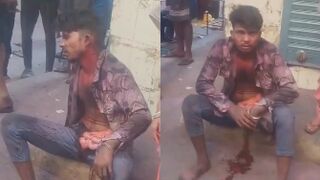 Man Stabbed In Stomach Suffers With Guts Exposed