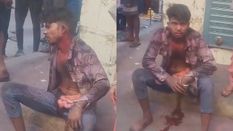 Man Stabbed In Stomach Suffers With Guts Exposed