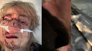 In Izhevsk, a thug brutally beat a guy over a fur coat