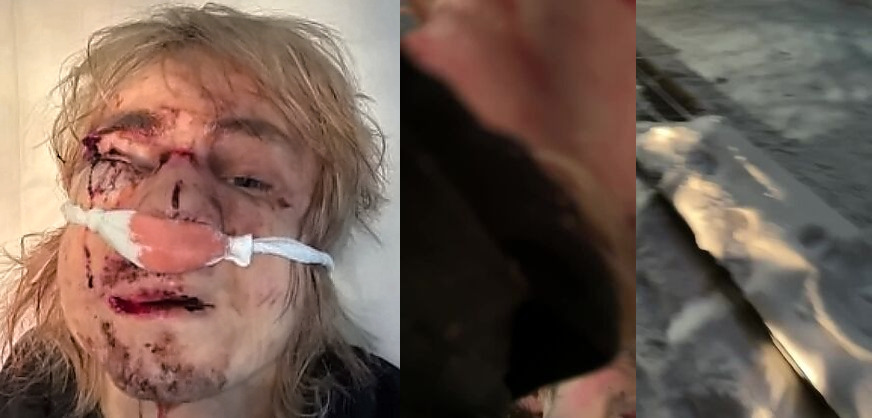 In Izhevsk, a thug brutally beat a guy over a fur coat