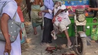 Old Man Lost A Limb After A Fender Bender