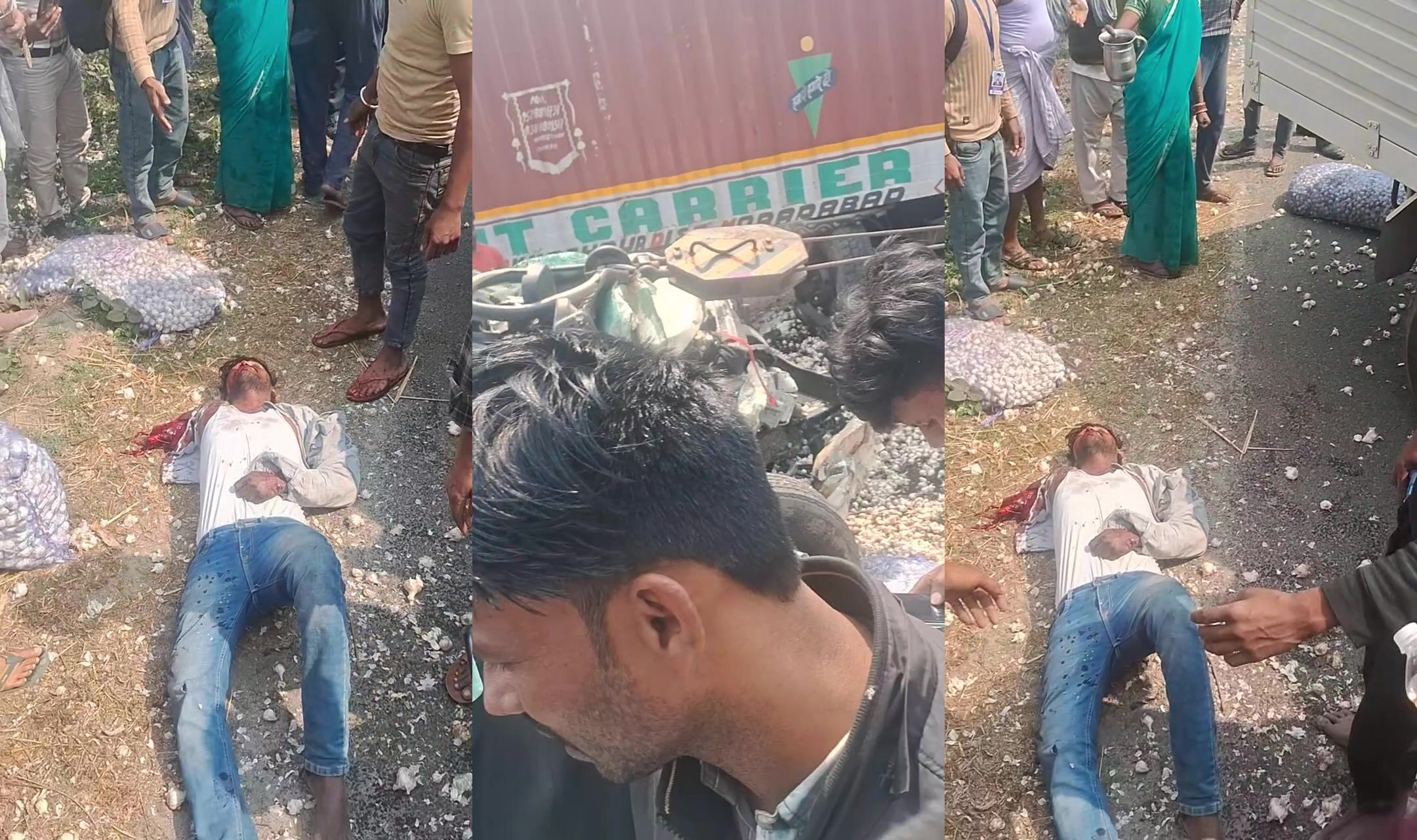 Arm lost in accident.