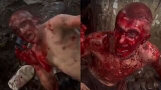 BRUTAL: Man Hammered For Stealing From Drug Lords