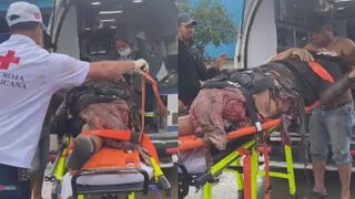 Man Turned Into A Living Mess Following A Traffic Accident In Dominican Republic