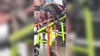 Man Turned Into A Living Mess Following A Traffic Accident In Dominican Republic