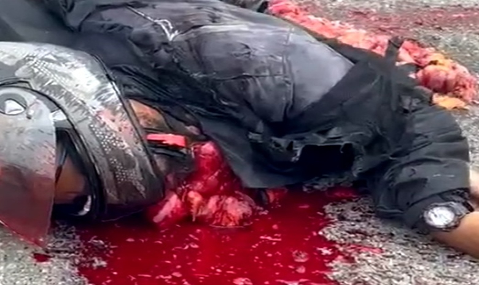 Intestines Out, Heart Still Fighting: The Gruesome Final Moments of a Speeding Biker