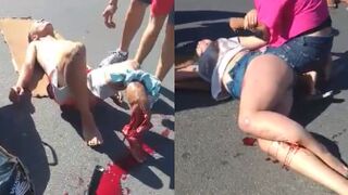 Couple On Honda Suffering Terrible Injuries