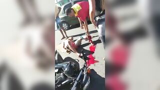Couple On Honda Suffering Terrible Injuries